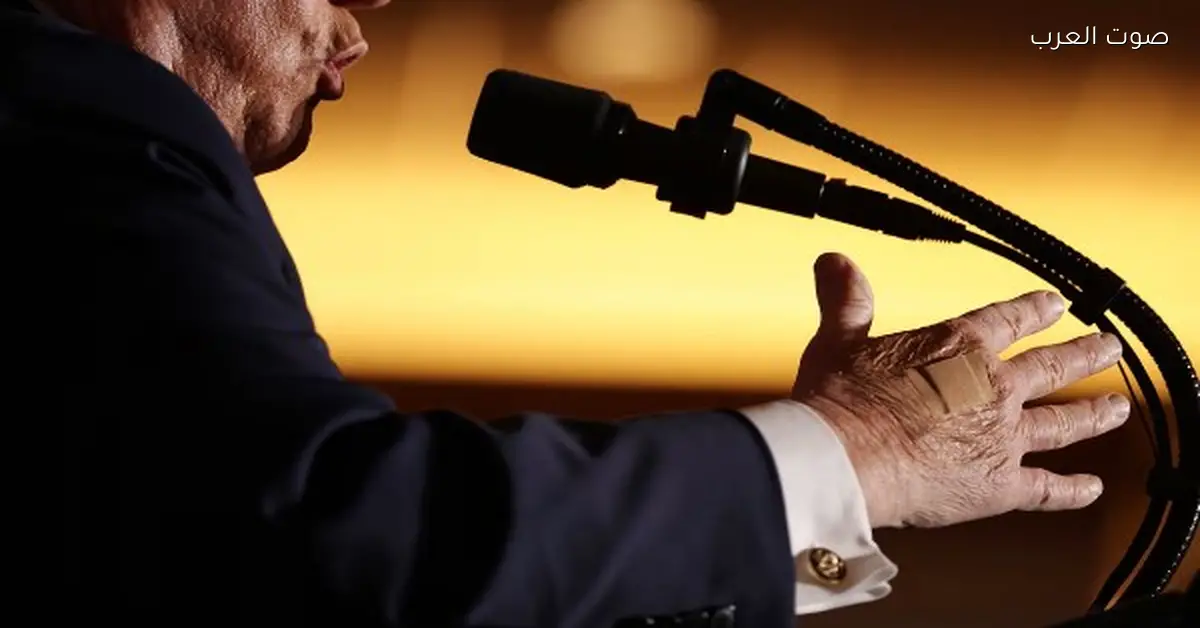 البيت الأبيض يكشف سر الضمادة اللي دايمًا على إيد ترامب