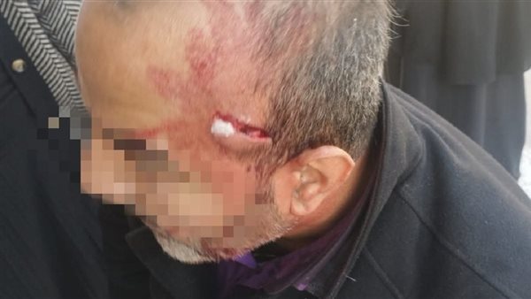 شخص يعتدي على معلم في مدرسة بالإسماعيلية 2 شخص يعتدي على معلم في مدرسة بالإسماعيلية