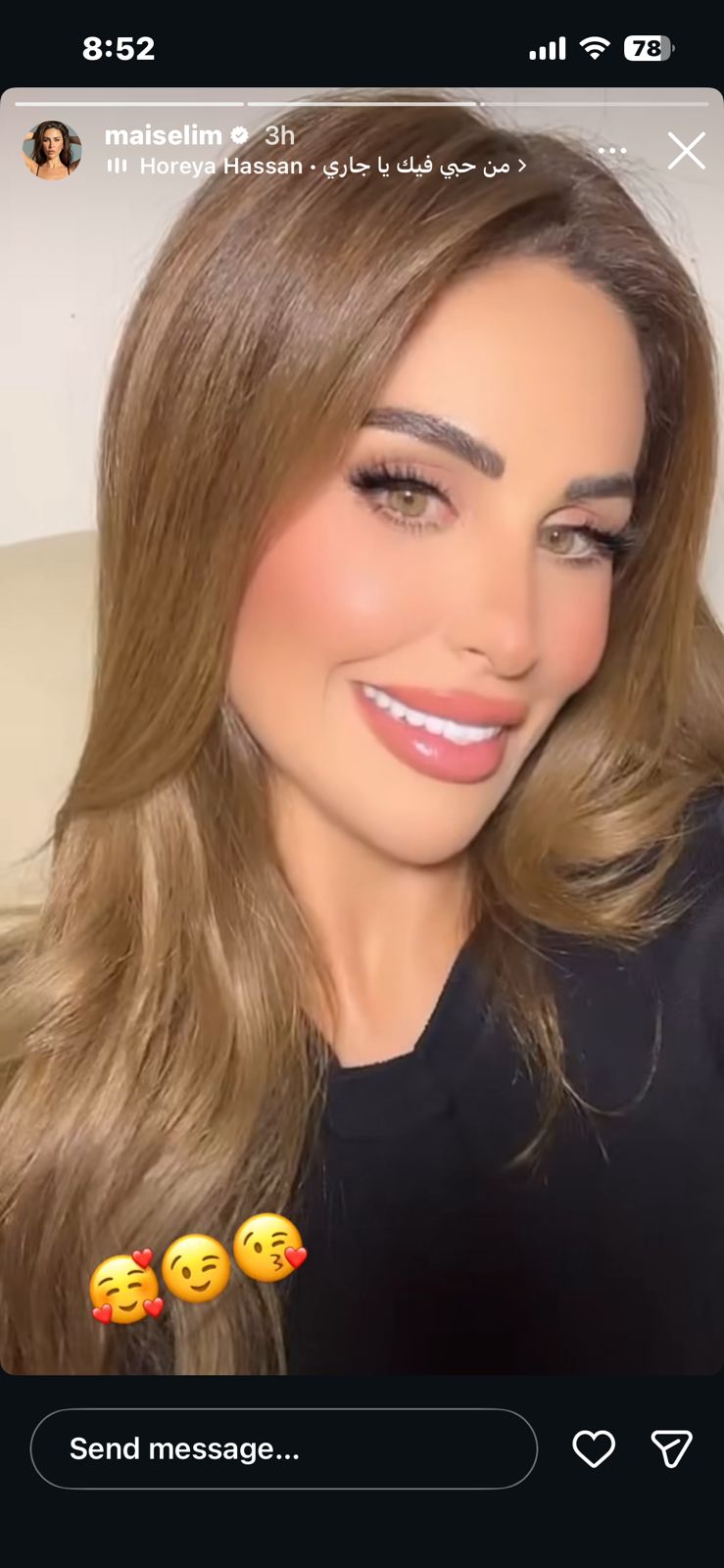 مي سليم متألقة في أحدث إطلالة ليها، شوفوا بنفسكم